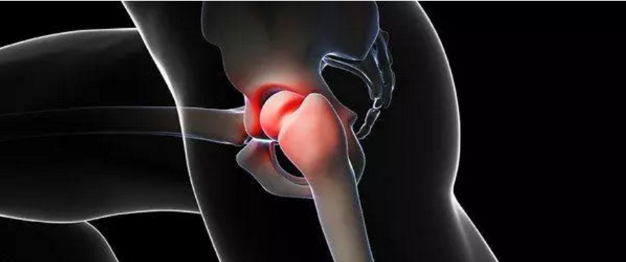 piriformis