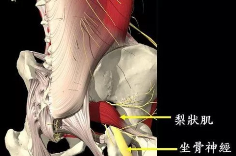 piriformis2