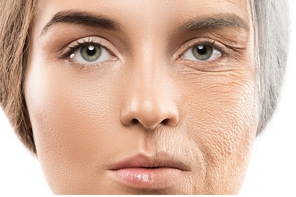 difference between fine lines and wrinkles